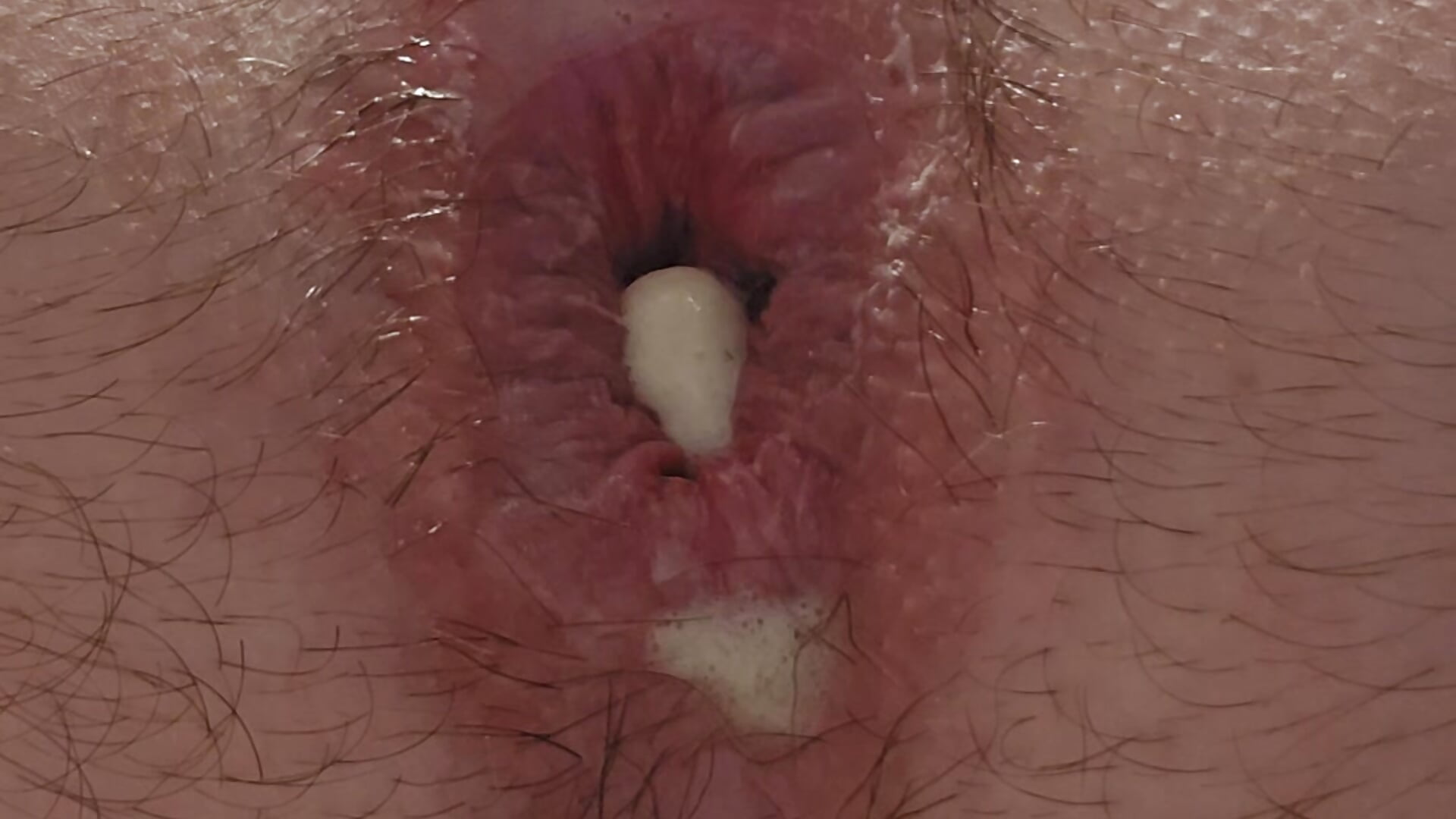 Anal 2 - Ddidier29 kullanıcısının videosu