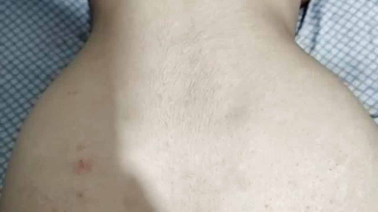 Anal/facial