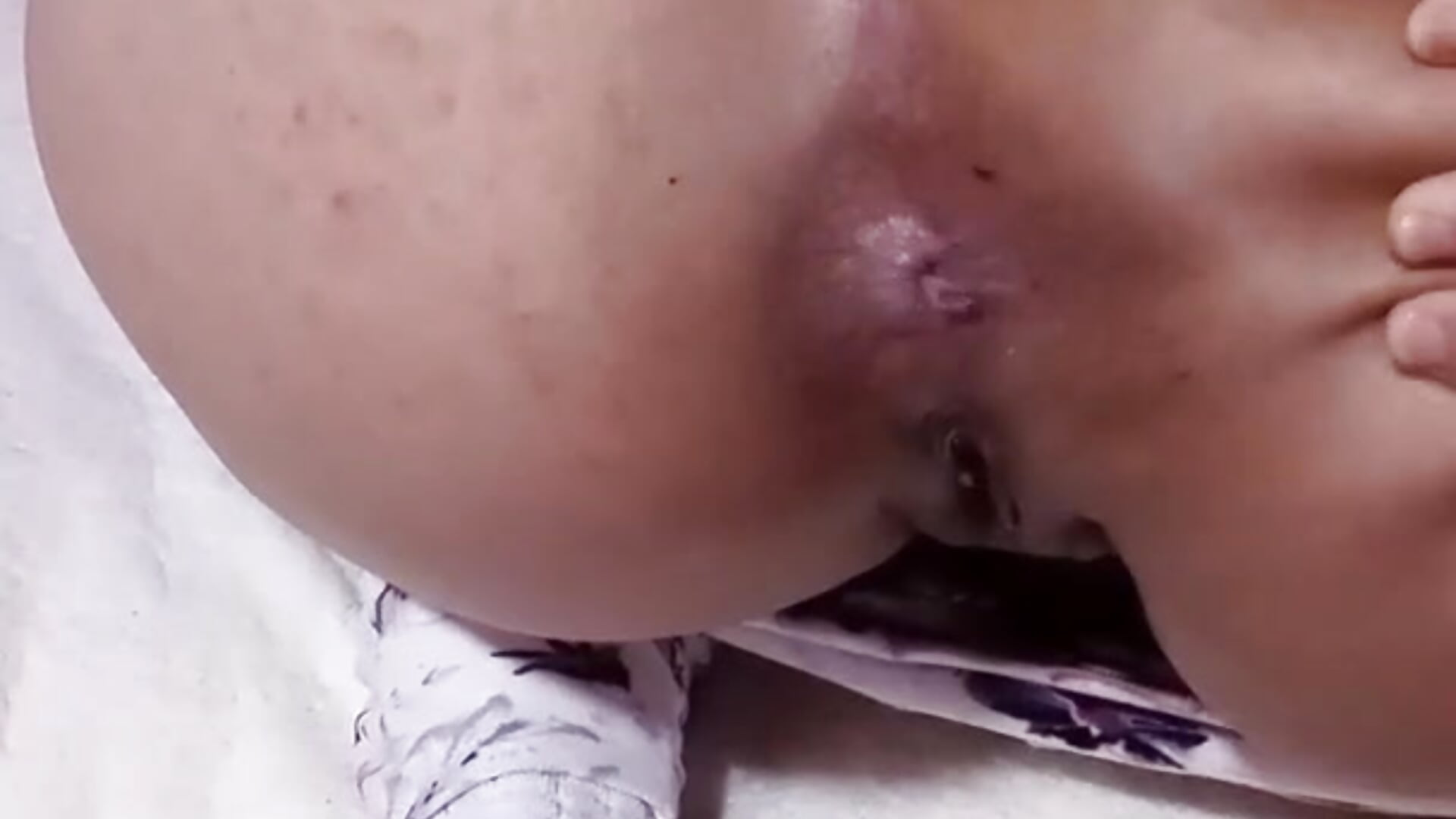 ☄️ضرطة حرقة fart طيزي مفتوحه oppen ass - فيديو من Bombamom موديل الكام