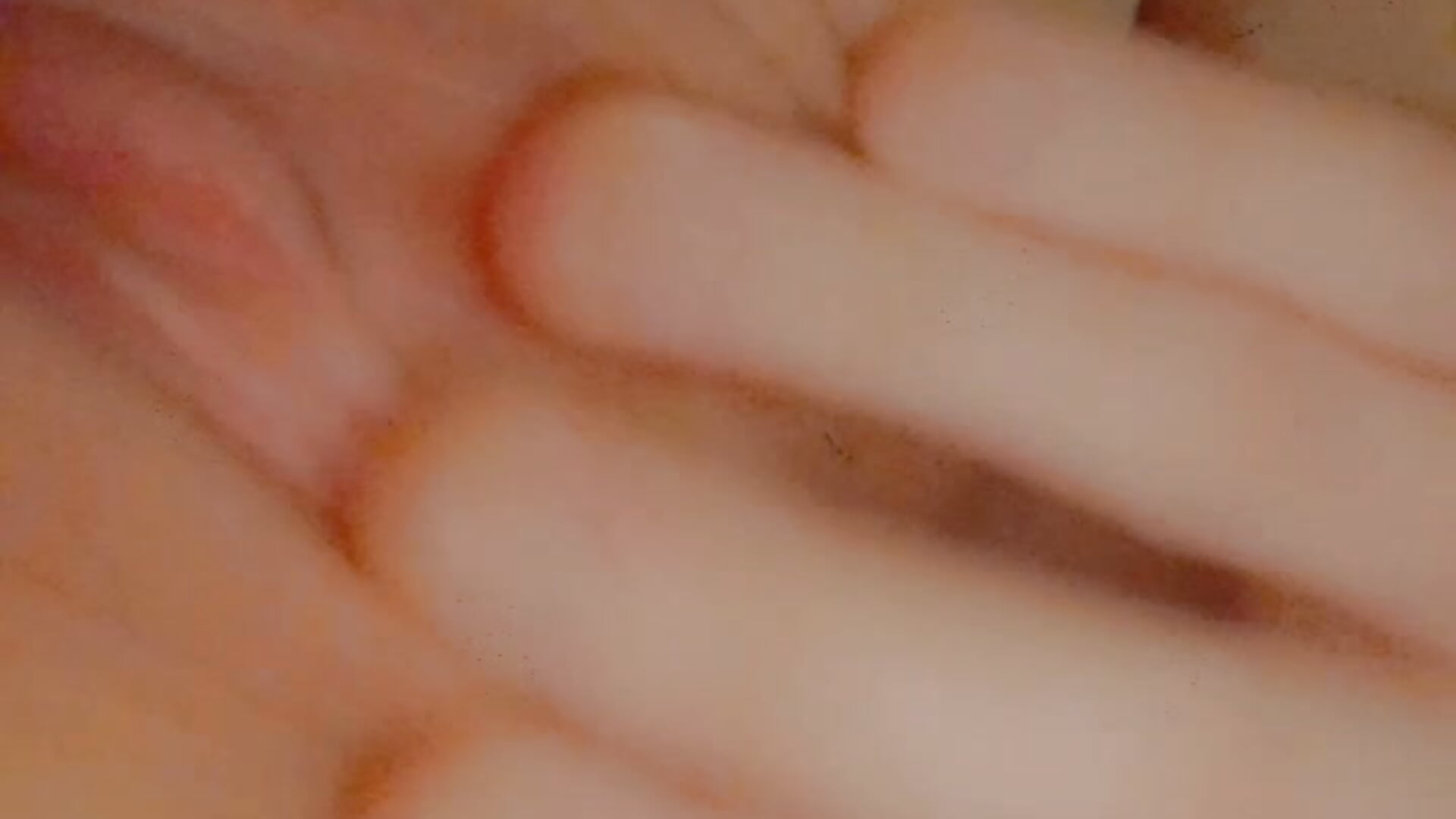 Teaser