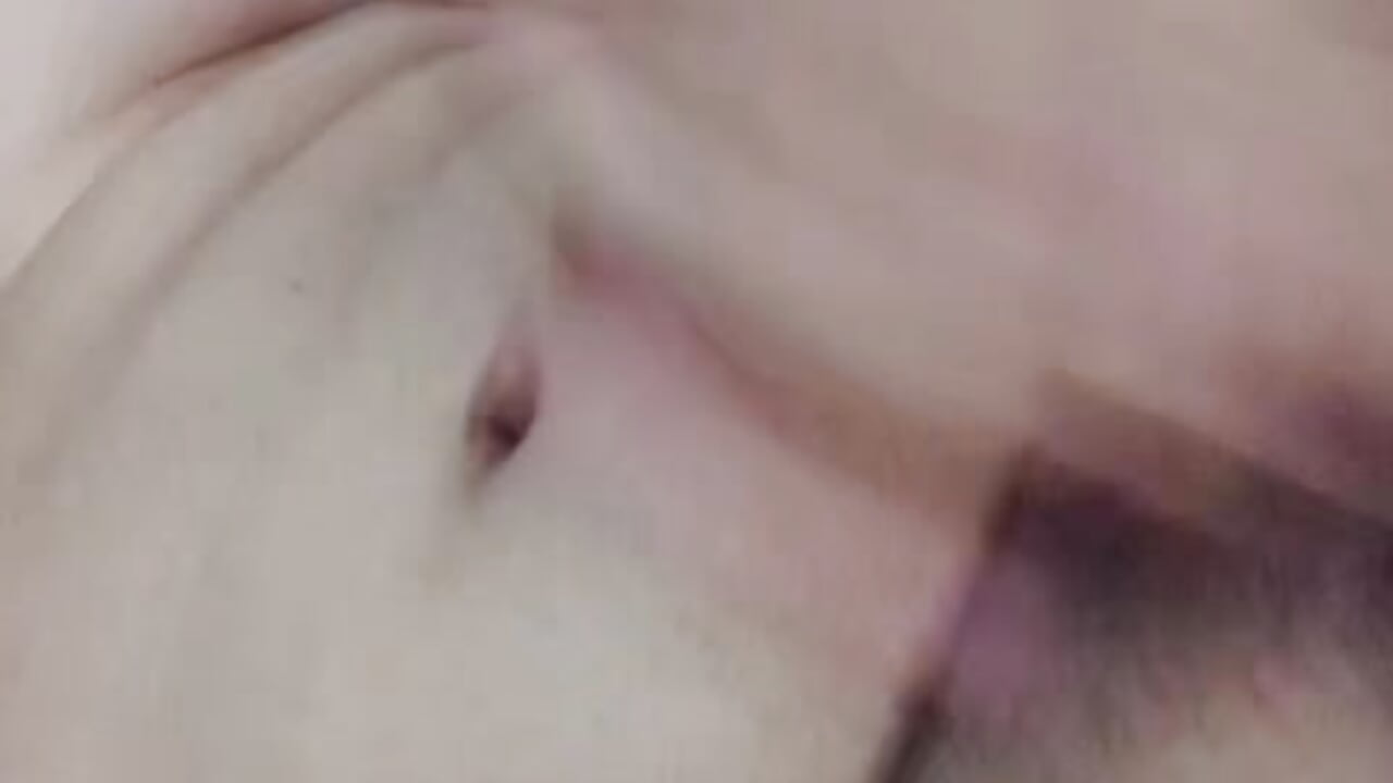 1000018913