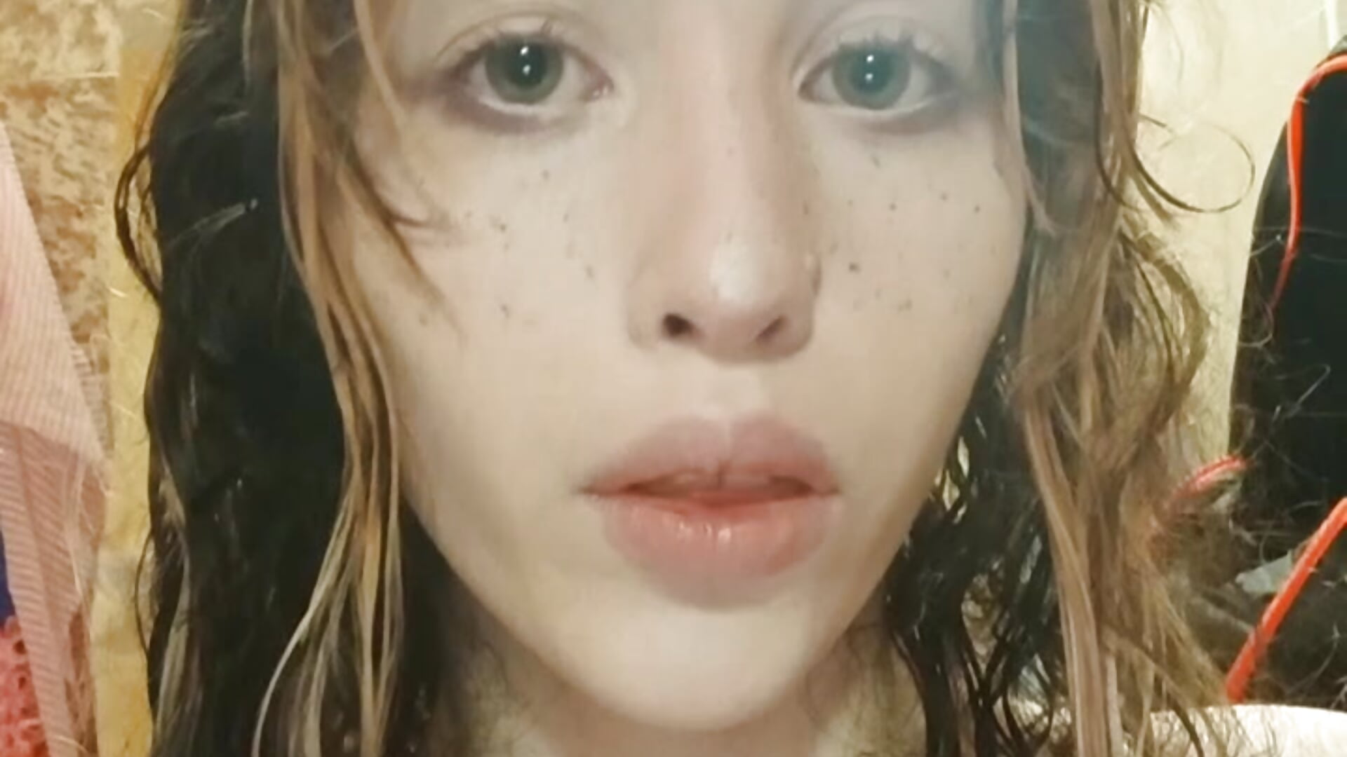 freckles baby