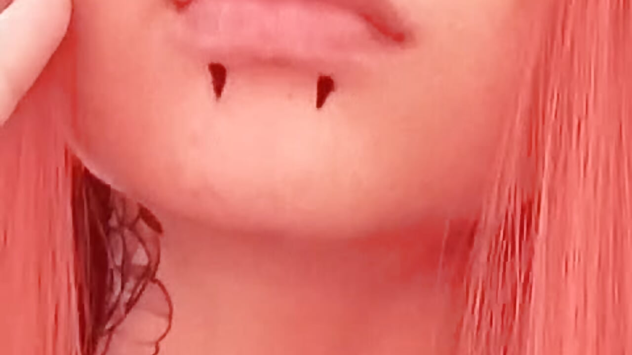 Pain