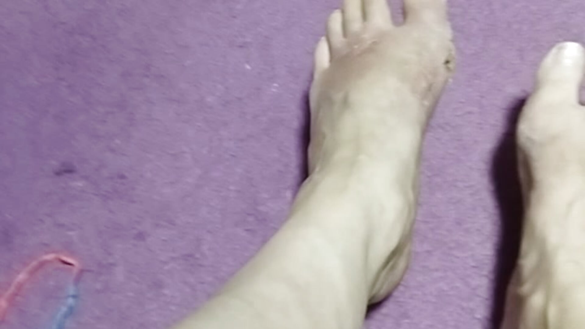 2 feet after surgery