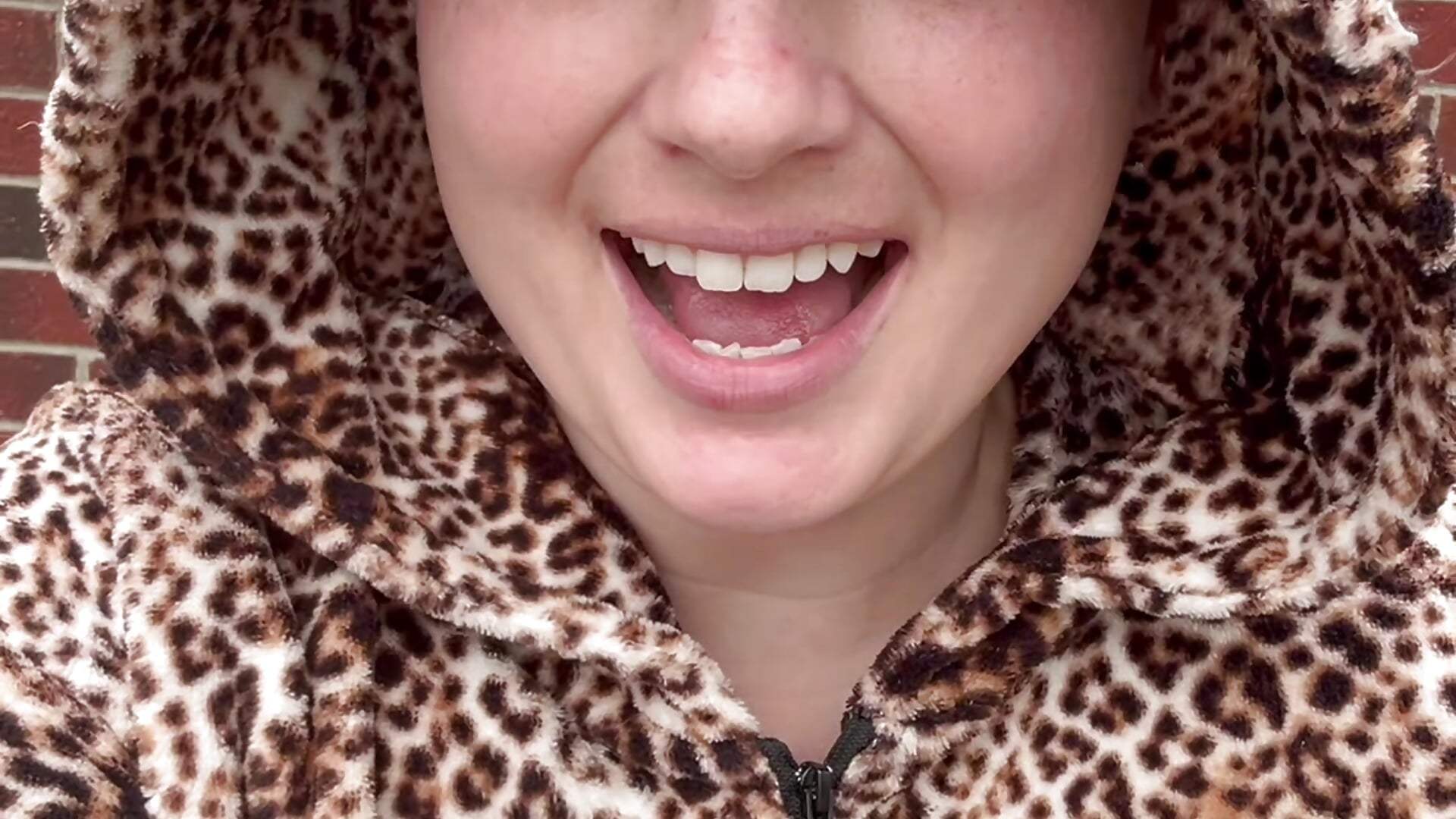 update on surgery tomorrow! I’ll have my phone on me after surgery for content. - video di MilfyMrsRobinson modella di cam