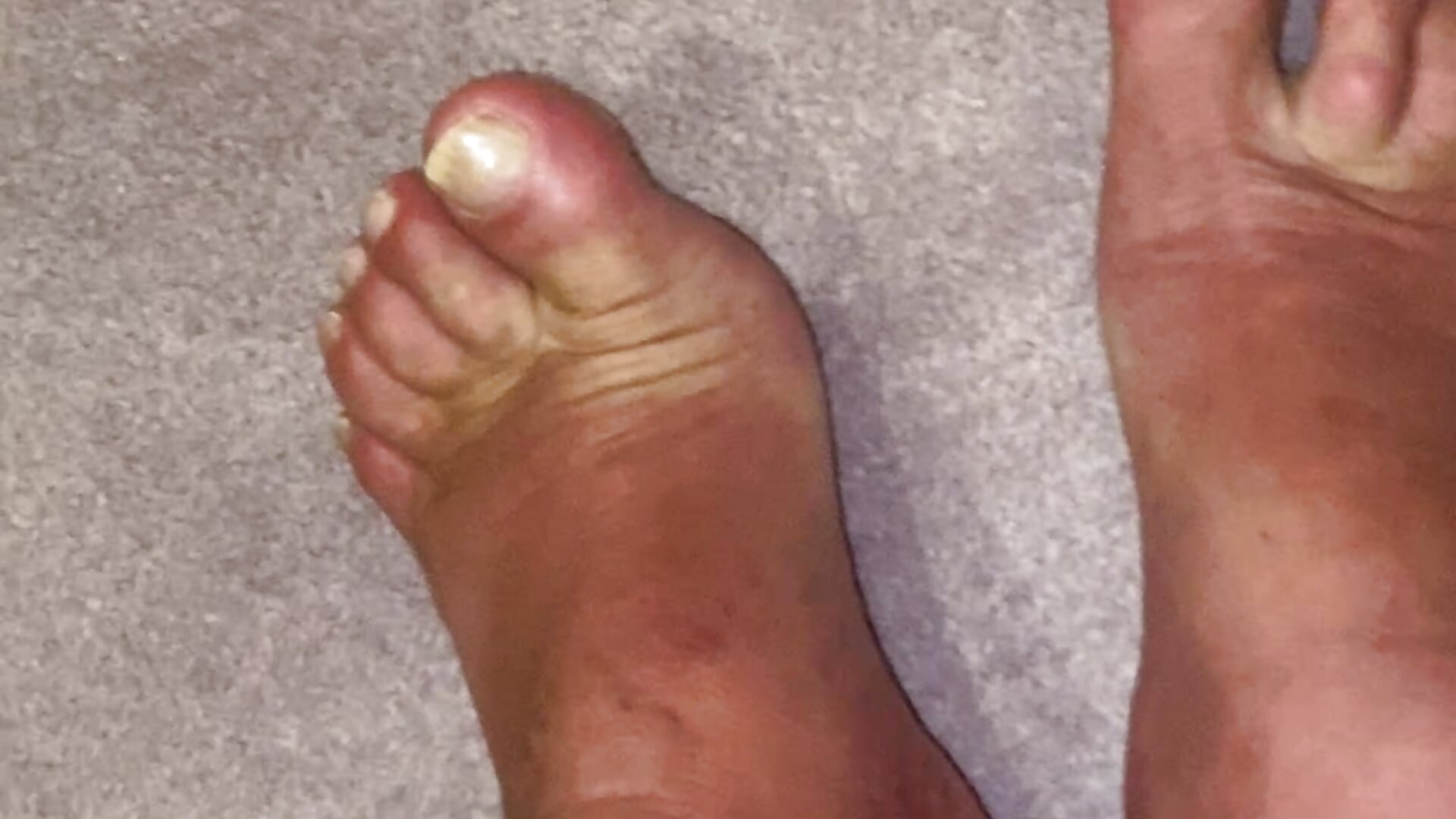 Feet Show – video od webkamerové modelky biggandybig