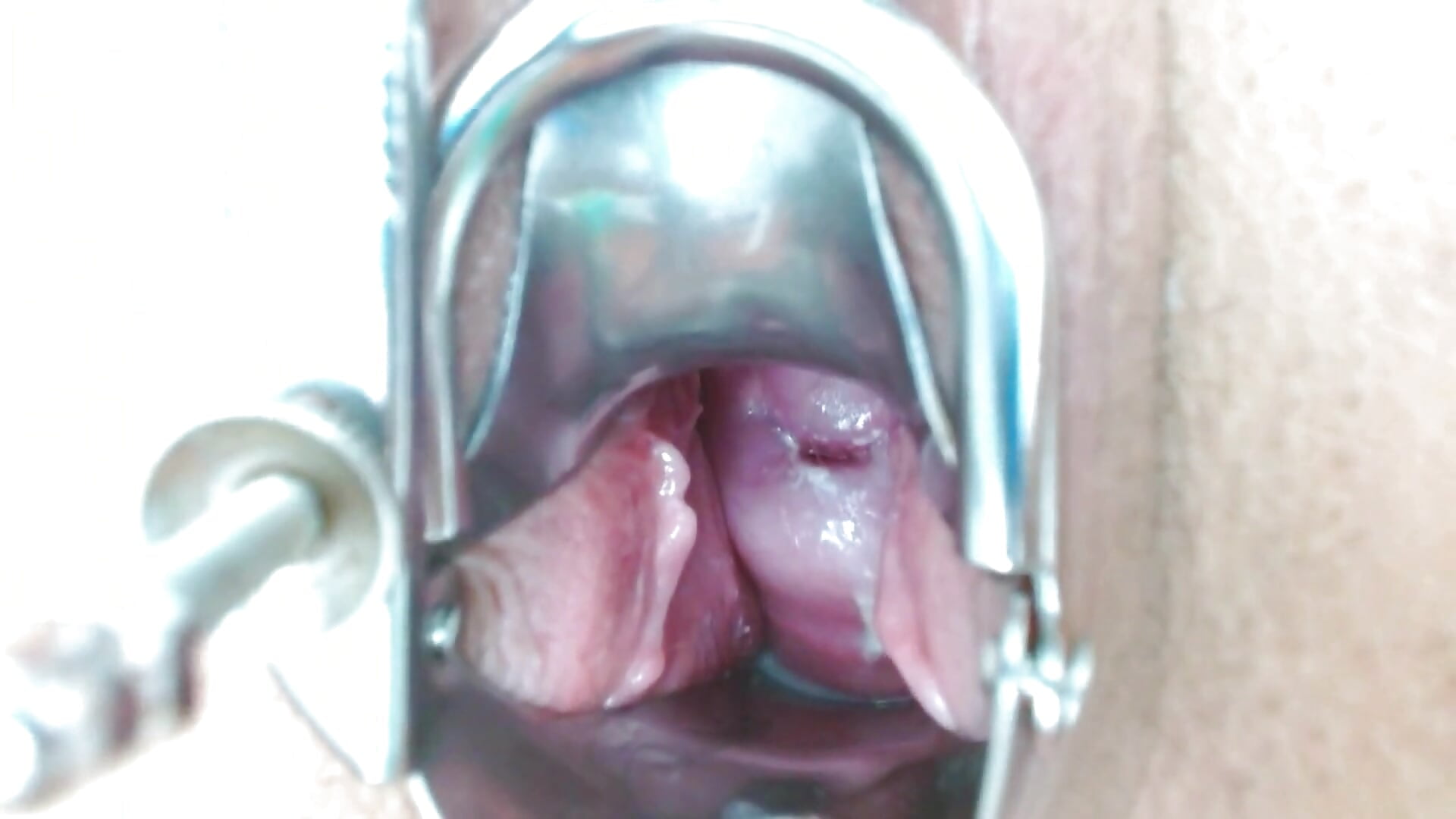 prolapse peephole and cervix - video by Darliin_G cam model