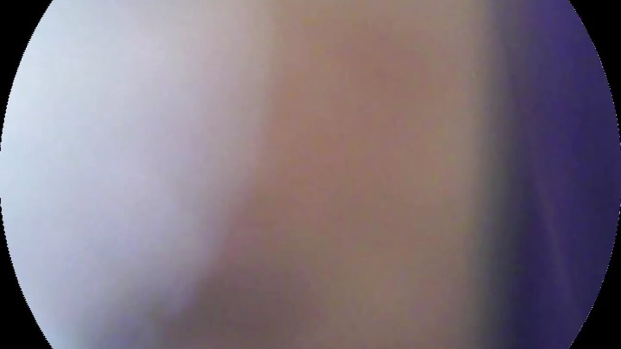 有白浆？Kiki的第二次阴道内窥视频 - Vídeo de nidekikibabe-2026, modelo de vídeos