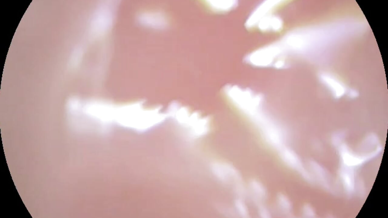 Kiki的内窥镜阴道宫颈视频 - Vídeo de nidekikibabe-2026, modelo de vídeos