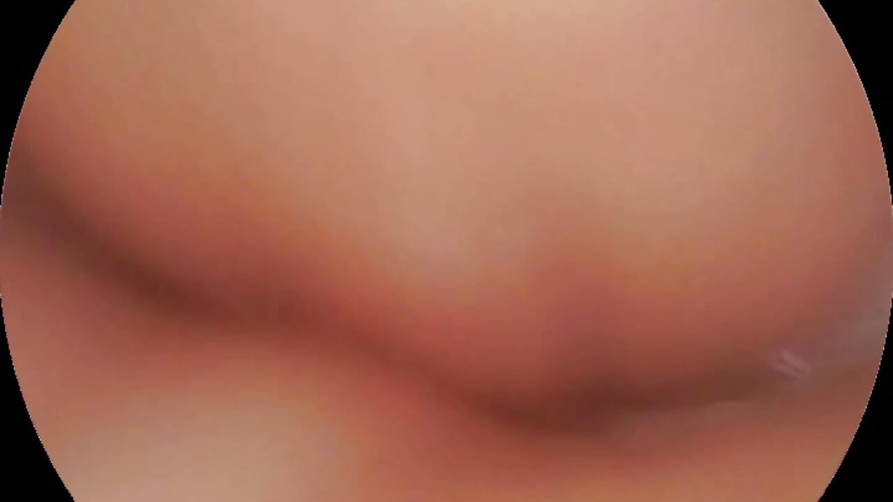 内窥镜宫颈白浆插入喷水 - Vídeo de nidekikibabe-2026, modelo de vídeos