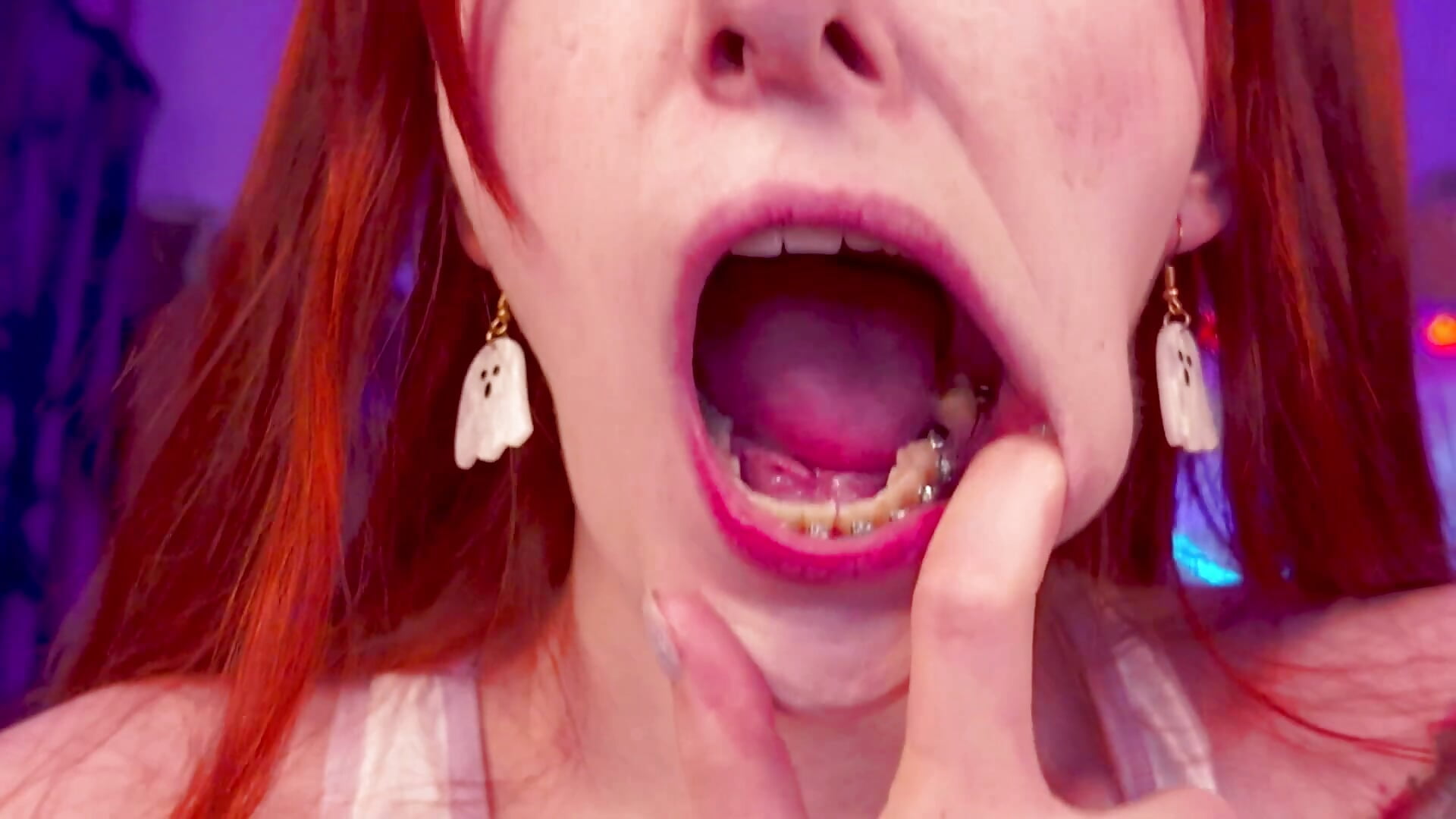 SFW Braces Elastics Close-Up