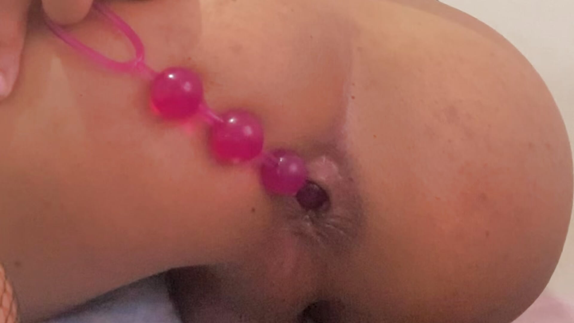 Anal beeds