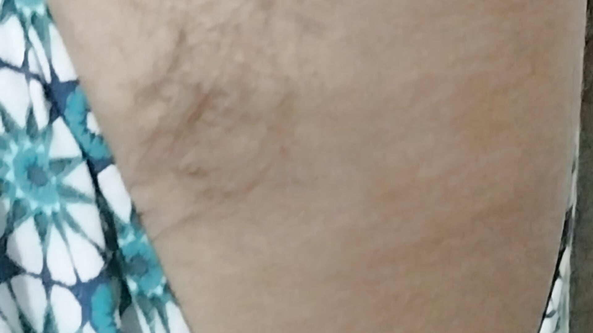 1000126571