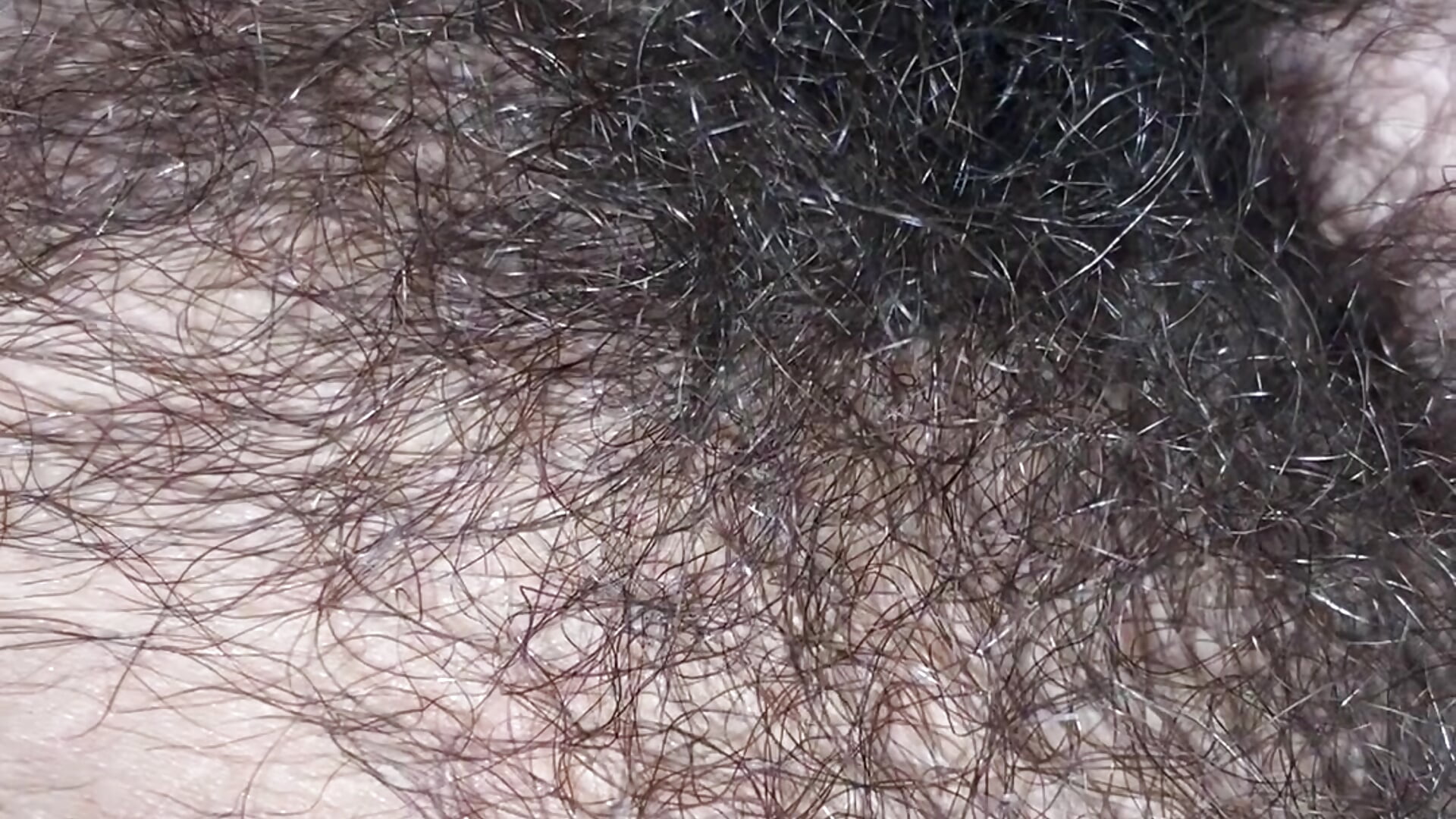 Pelos