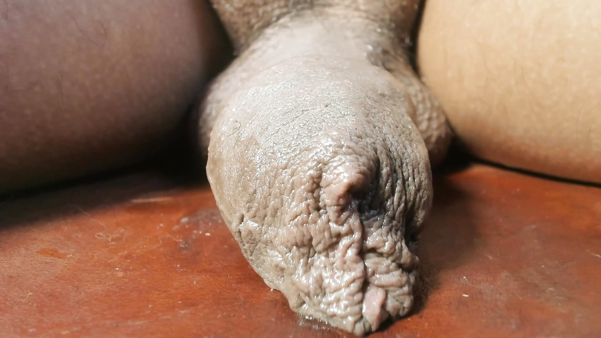 hanging foreskin