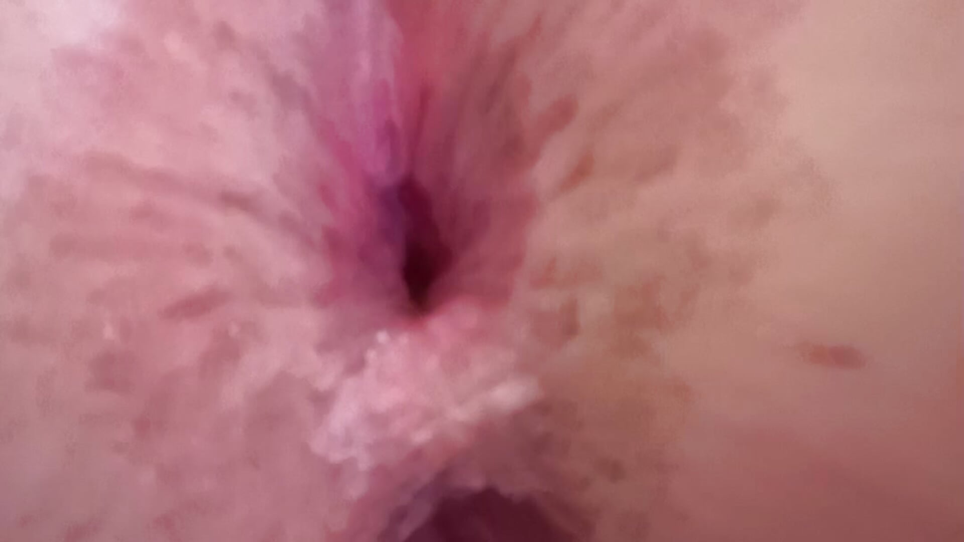 Zoom anal vaginal dilaté