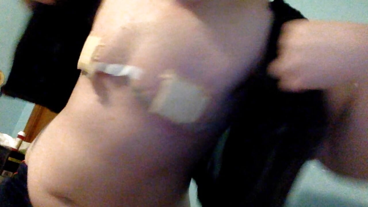 Top Surgery Results – video af MABlueLilly