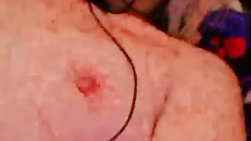 🍒