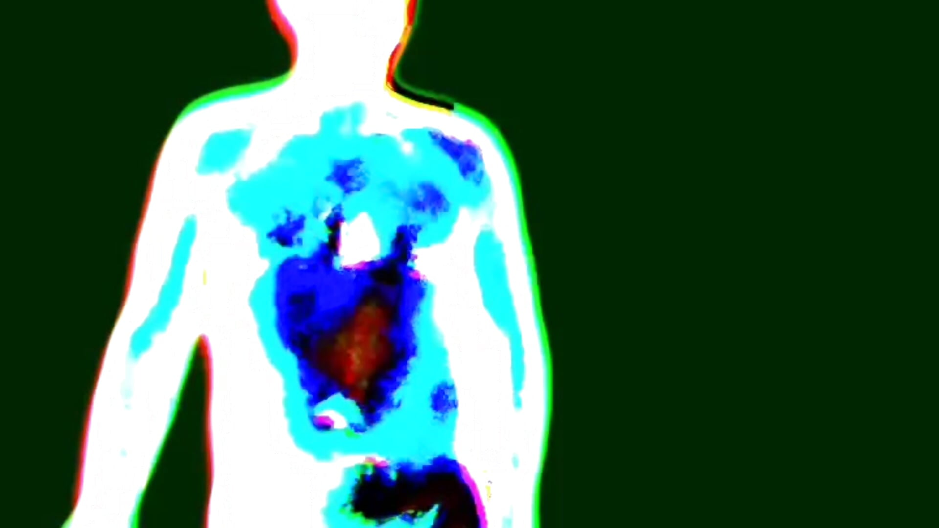 1EB7C4CF-17D9-442F-80D5-769D721149A0 - vídeo de la modelo de cam alanan881