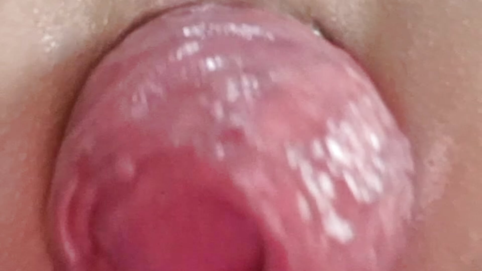 Prolapse anal - video av kittyy25 cam-modell