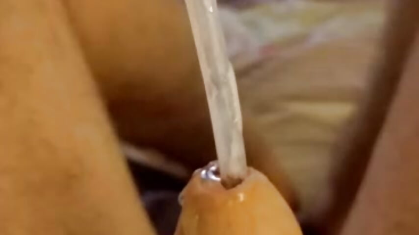 tube insertion
