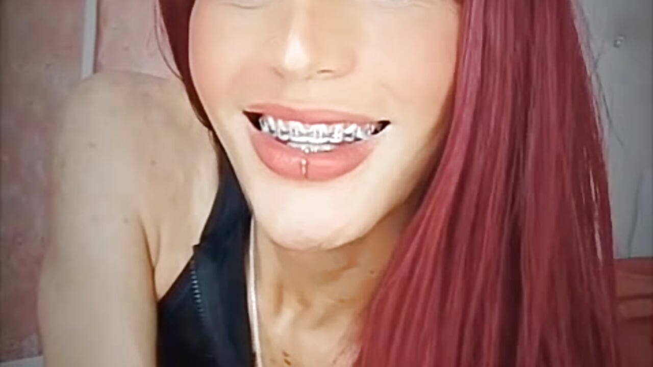 Braces 💋 - відео від вебкаммоделі NahomiWhitel