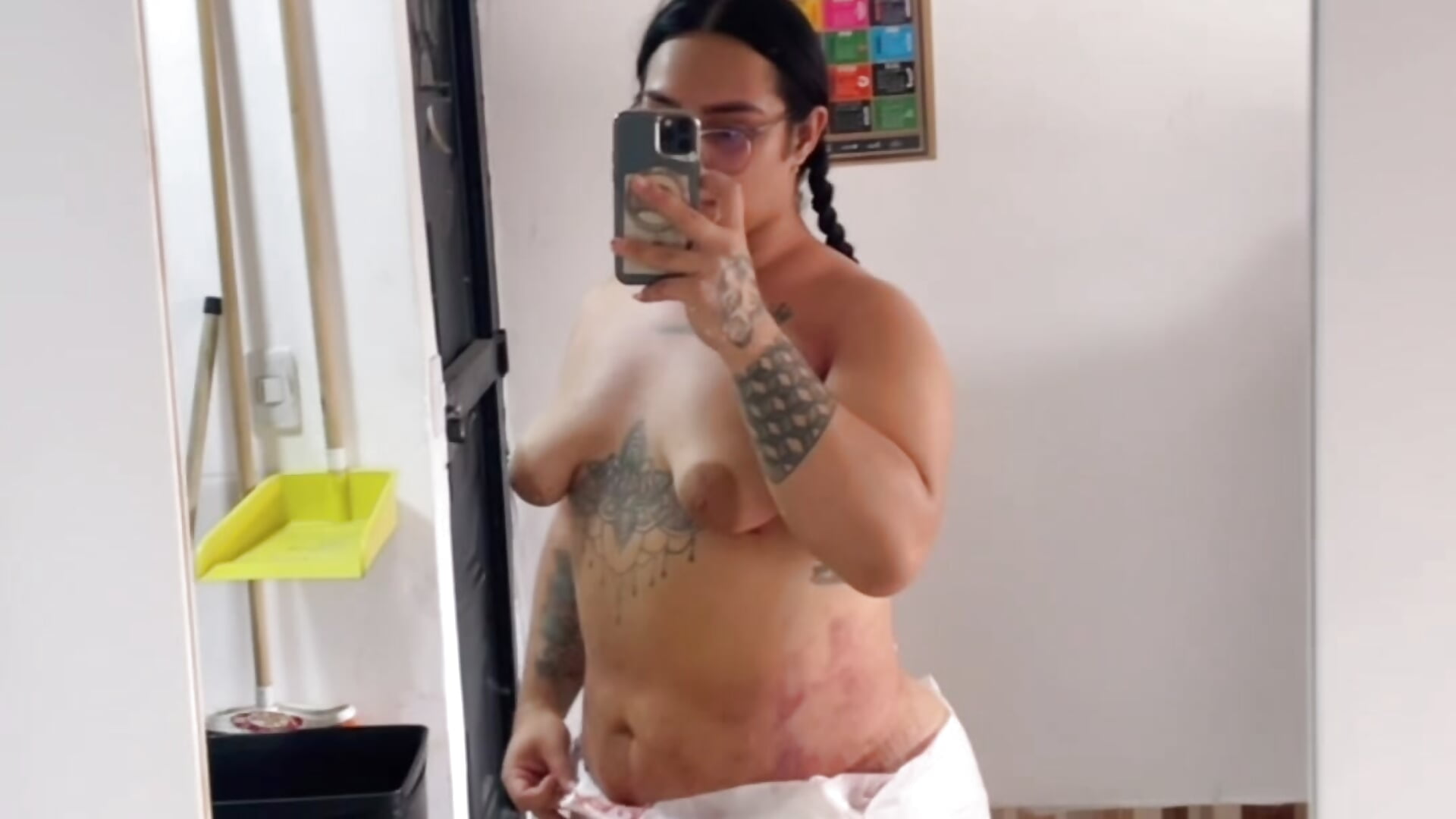 My abdominal surgery, love