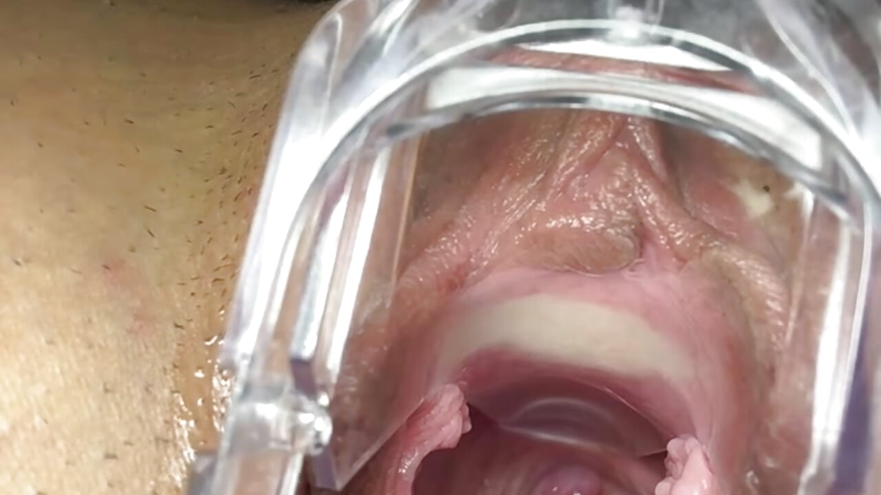 Cervix red🤪