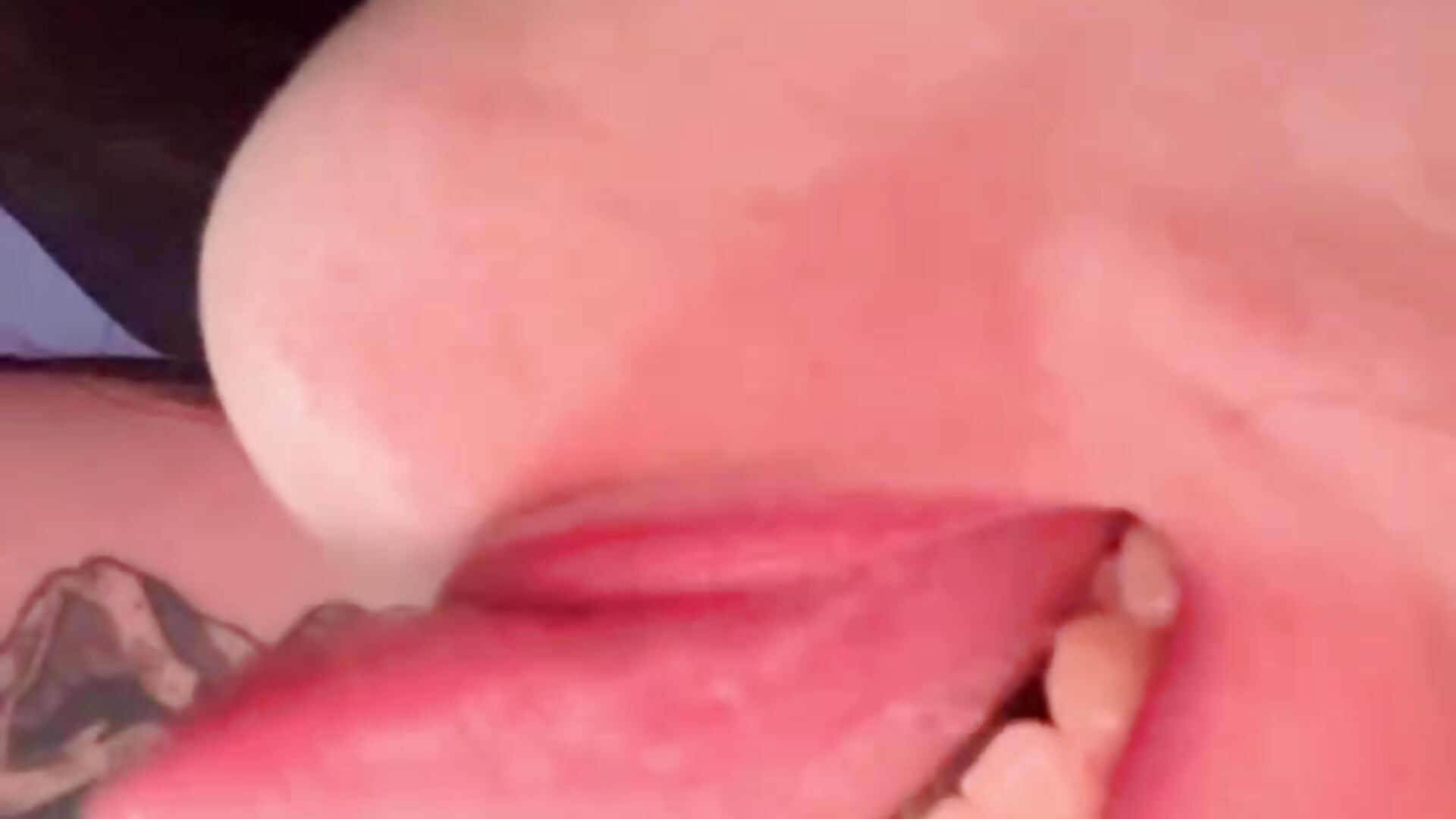 KISSES ATTACK!