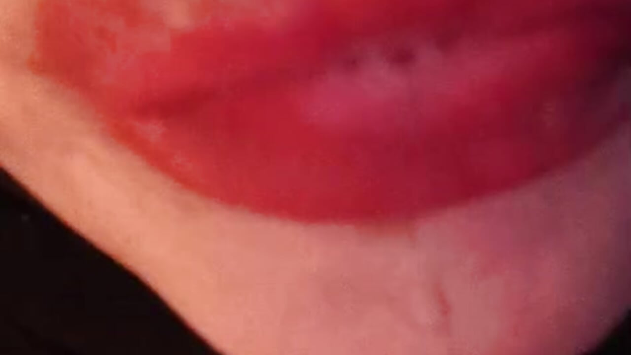 spitting in your face