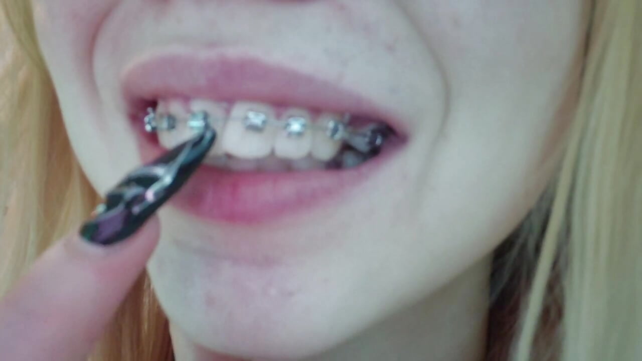 braces－カメラキャストのLynetHakesの動画