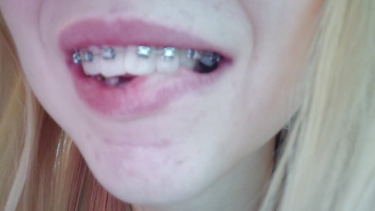 braces 2－カメラキャストのLynetHakesの動画