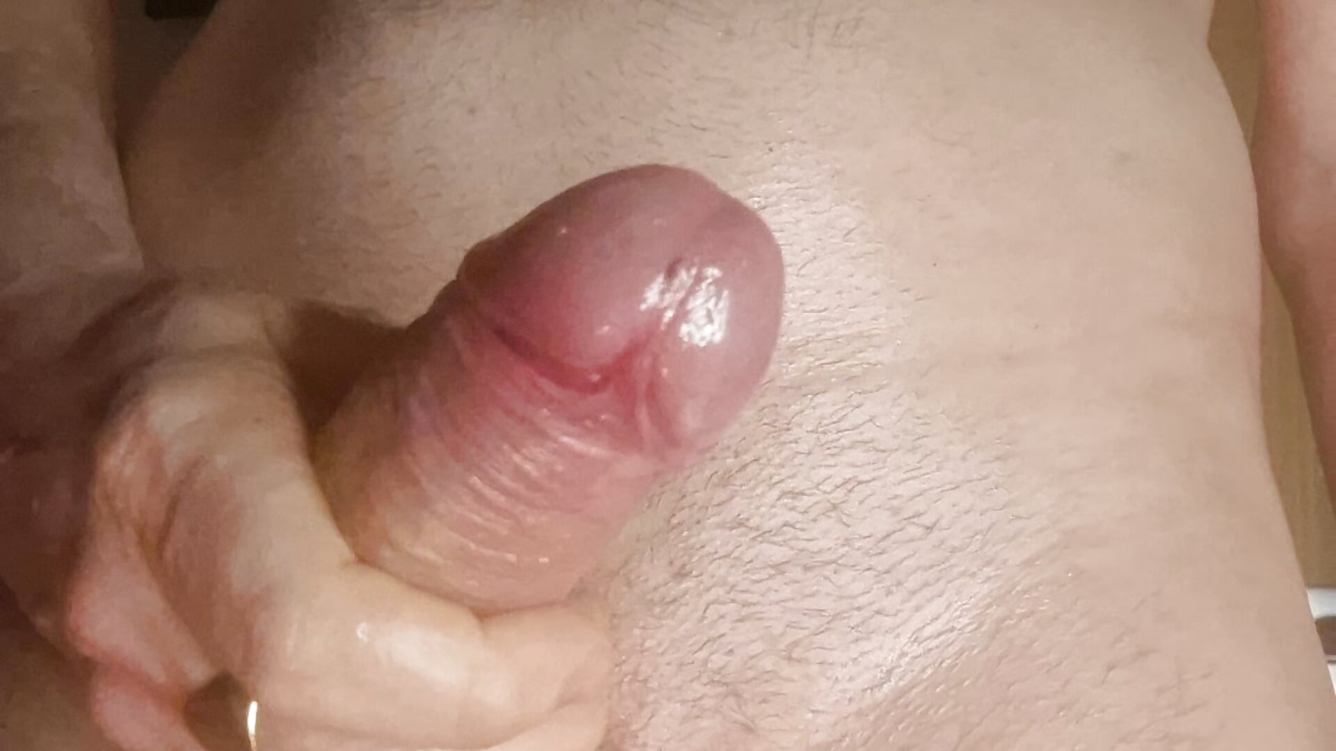 1000037237