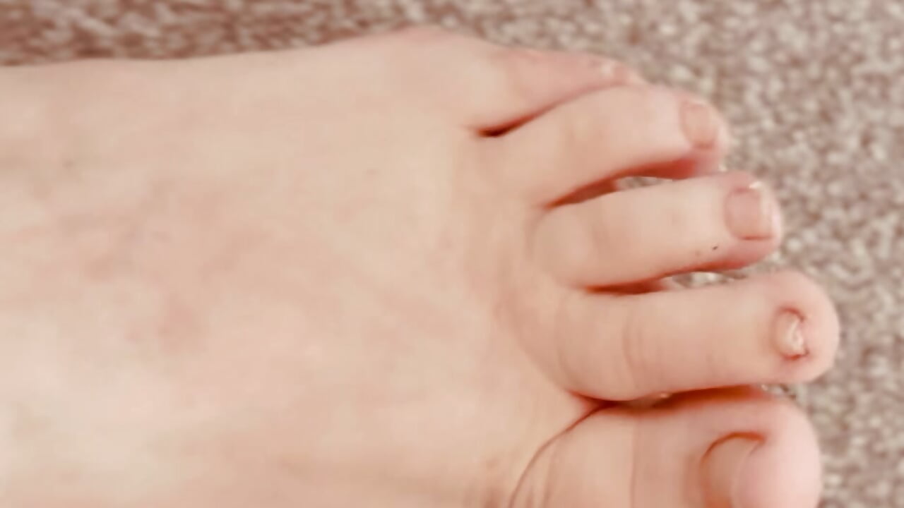 WIGGLING TOES