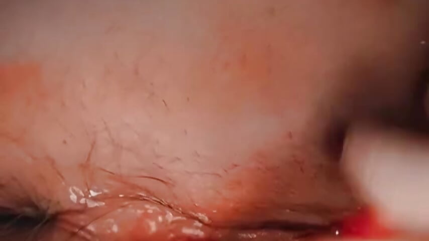 Squirt