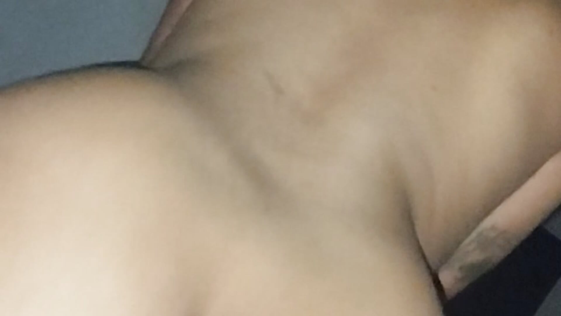 1000044241