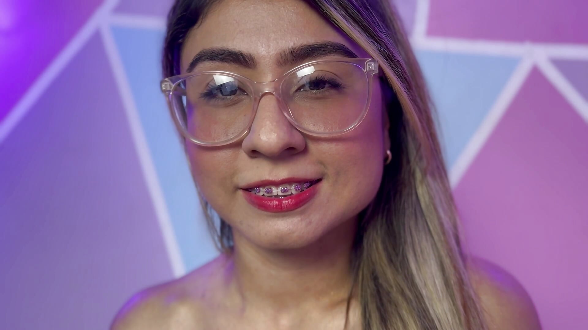 My braces really is very cute! ❤️