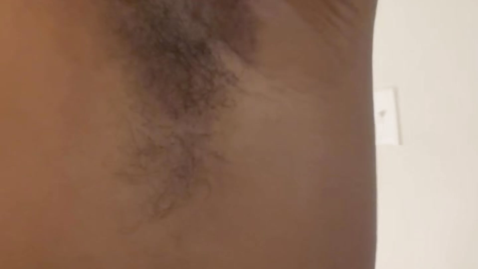 My Arm pit