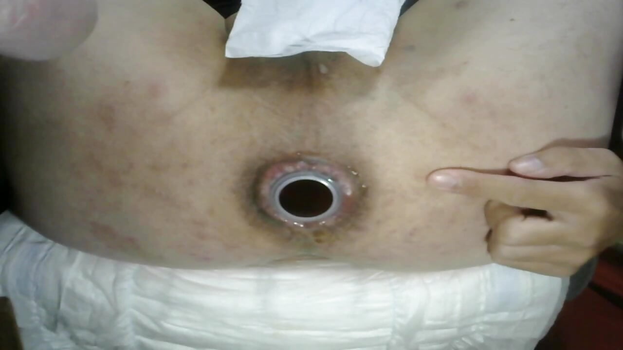 (2025-10-21) 配信５回目 Sample - video by AnalOnaniePlay cam model