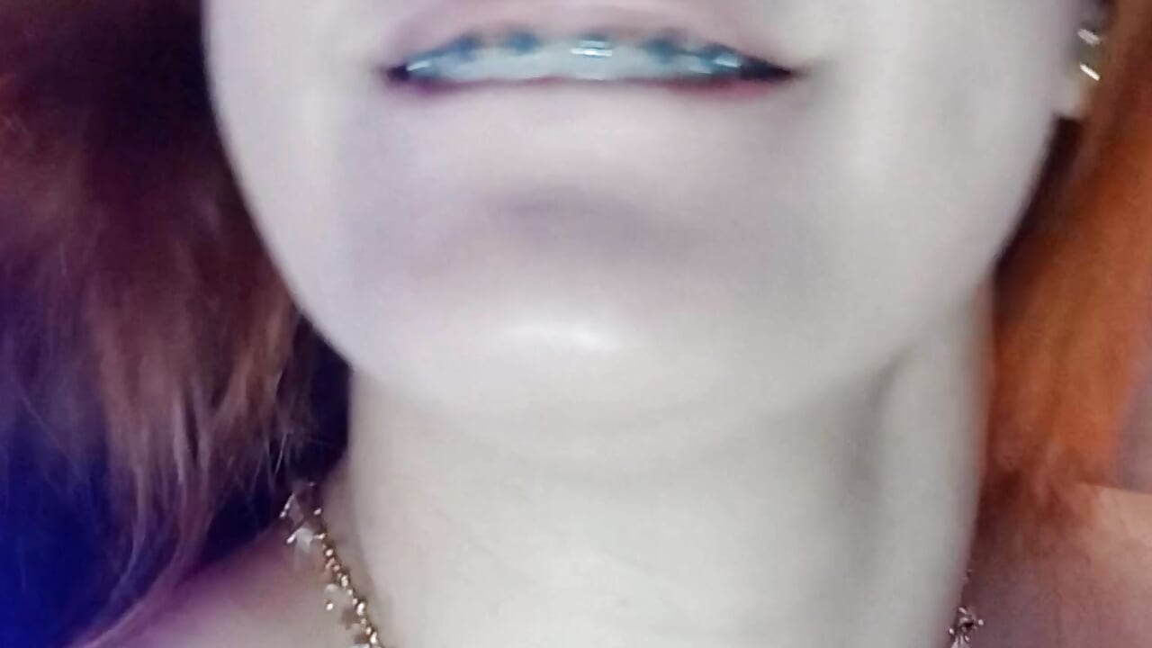 Play of elastics (Braces)