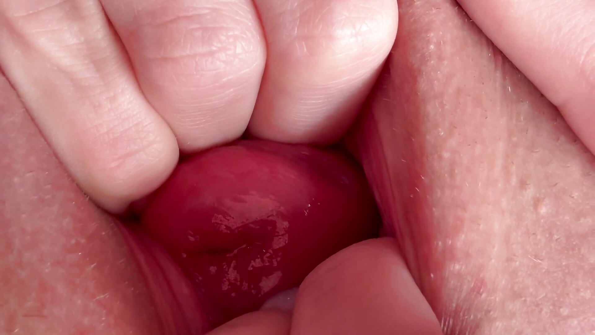 The cervix is very VERY close to the chamber💕💕