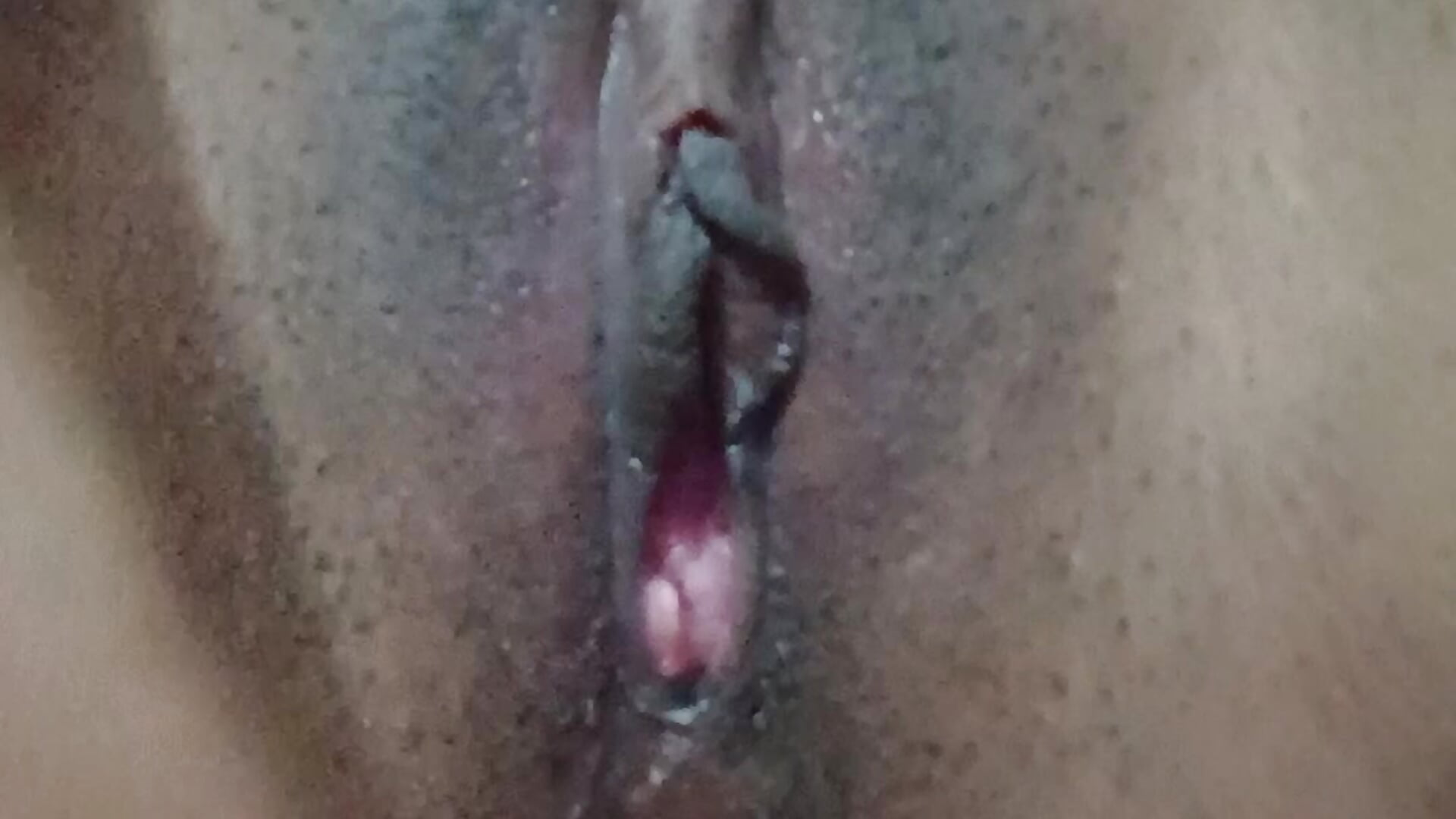 1000155049