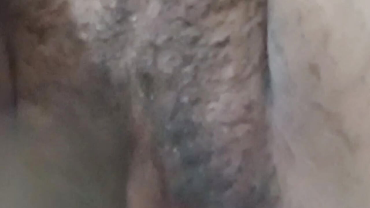 1000159435