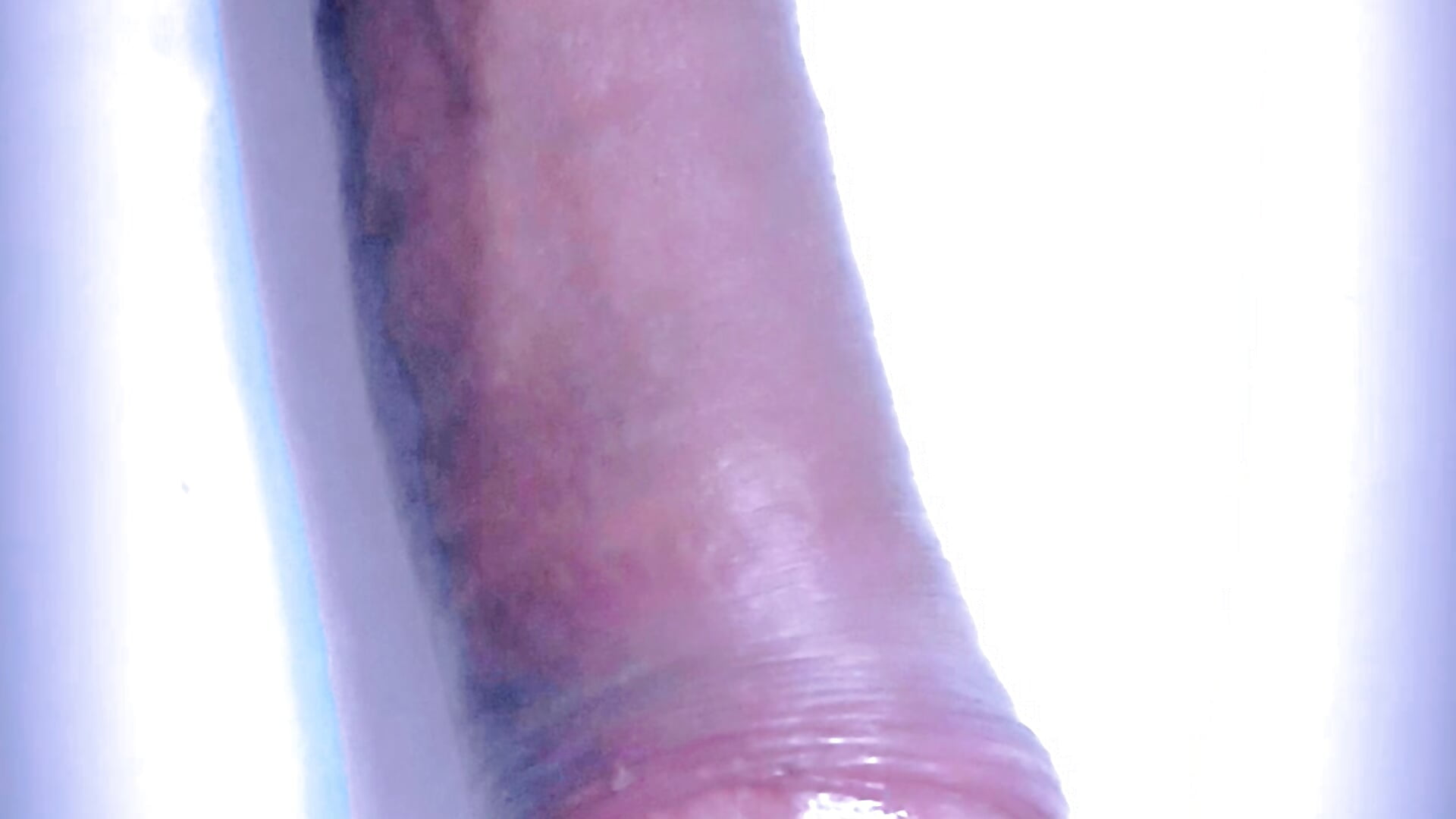 1000277915