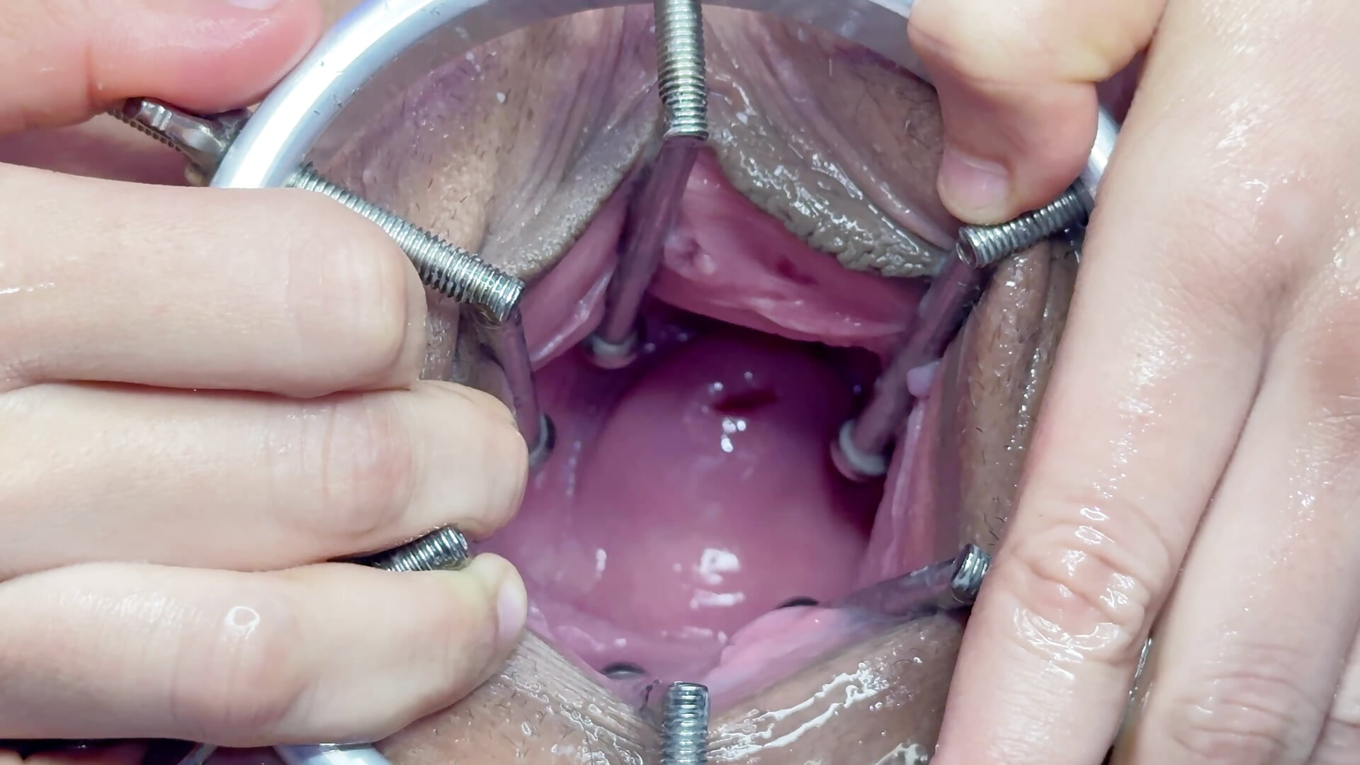Prolapsing my cervix with the speculum🫦