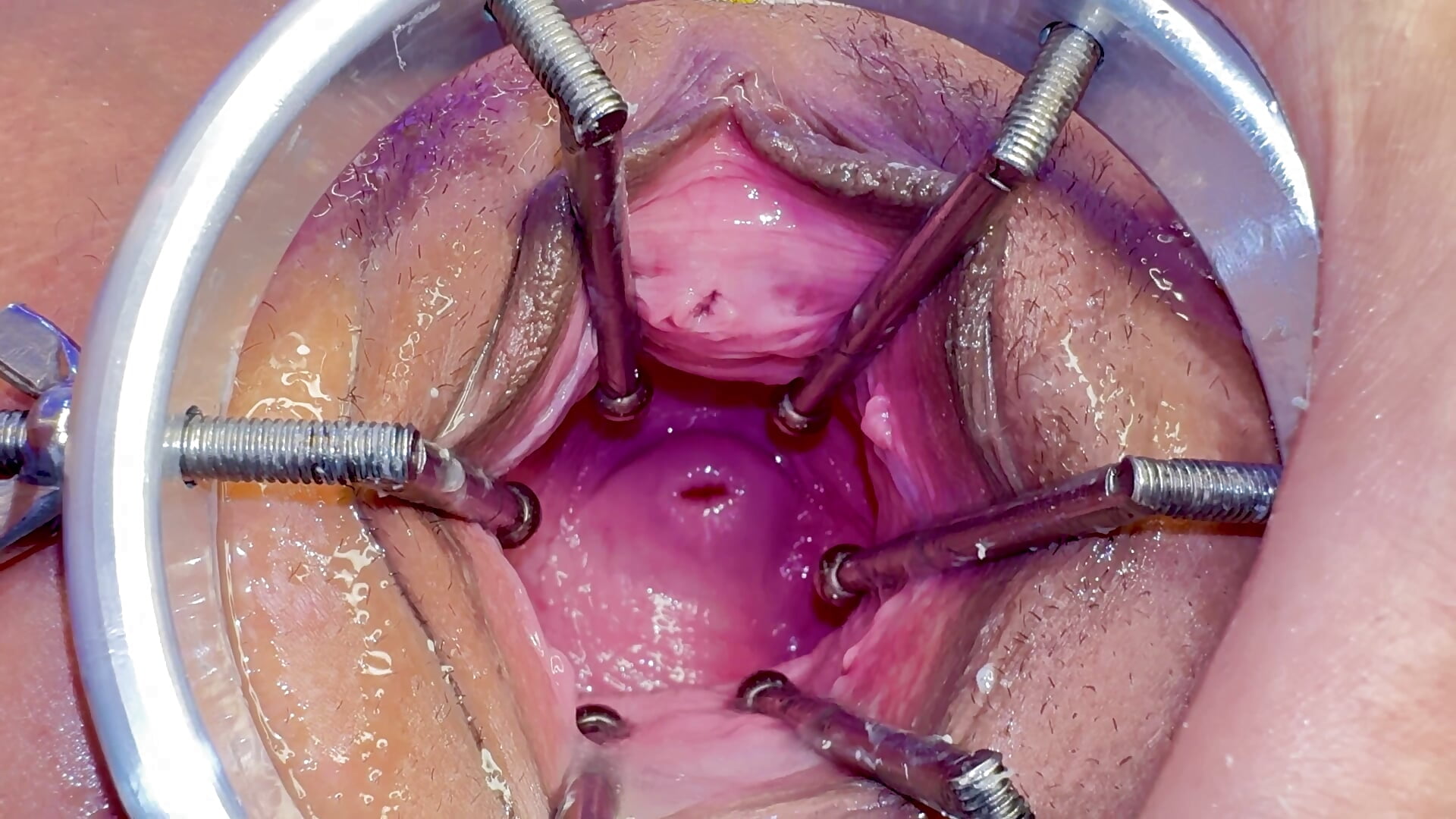 Expanding my pussy with speculum