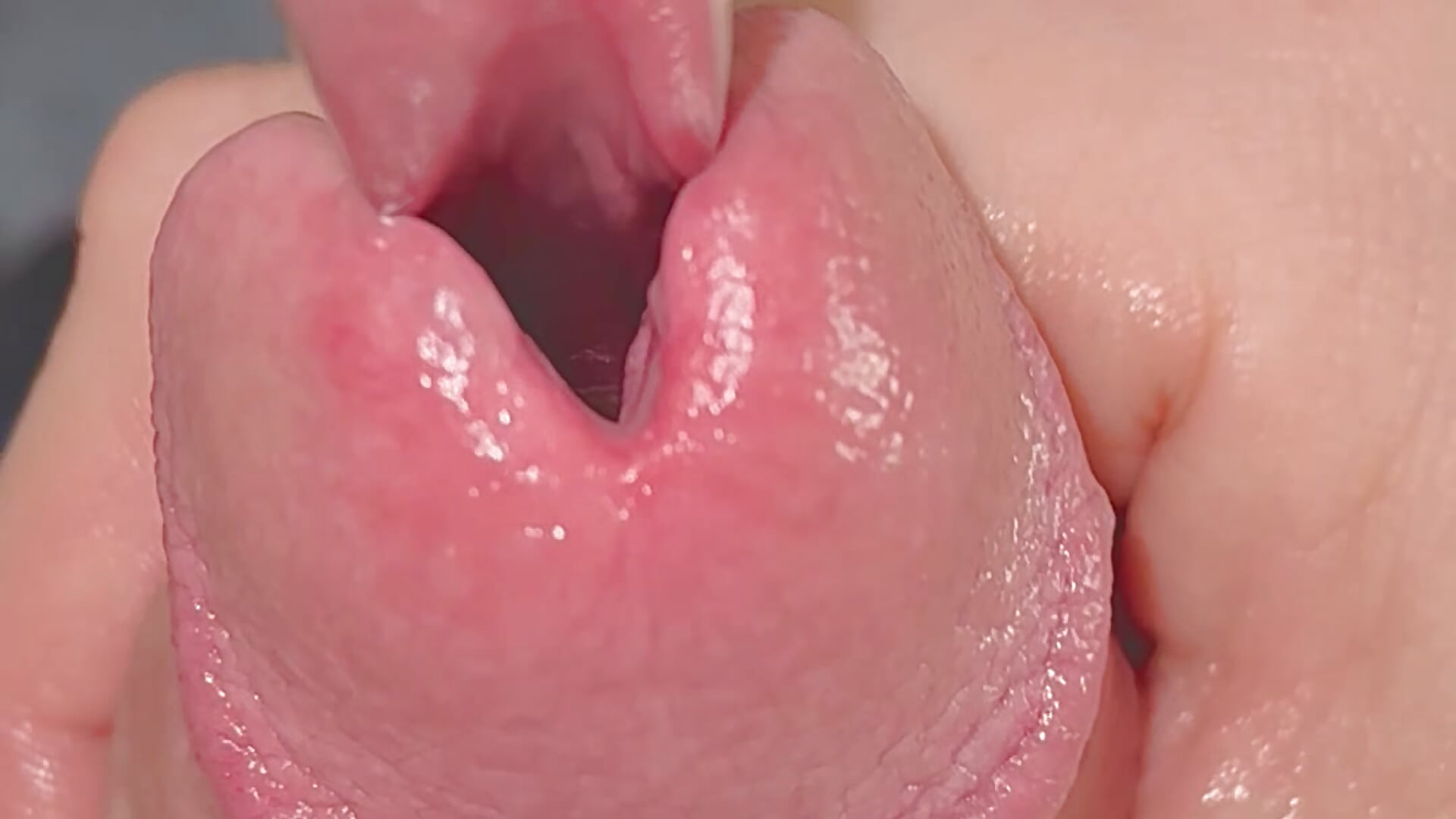 priv. Urethral Sounding Request