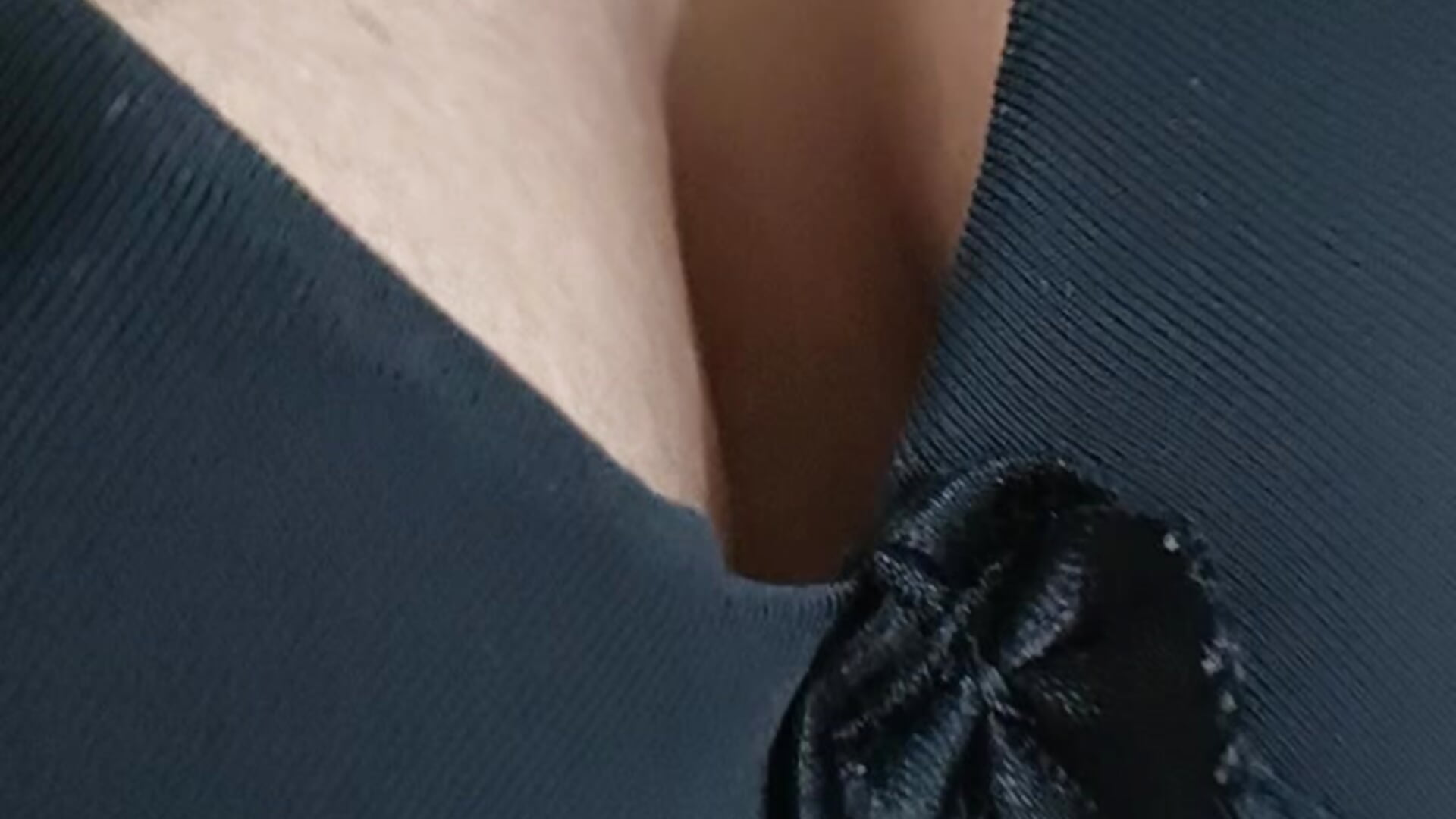 198