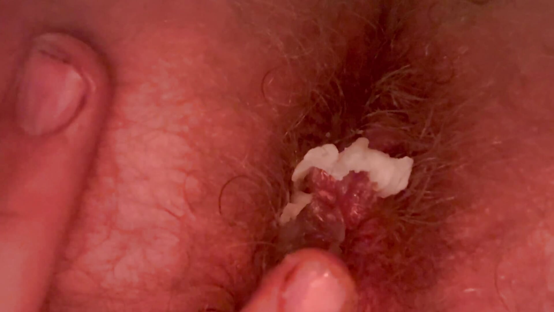 First prolapse - video by herbs__and_spices cam model