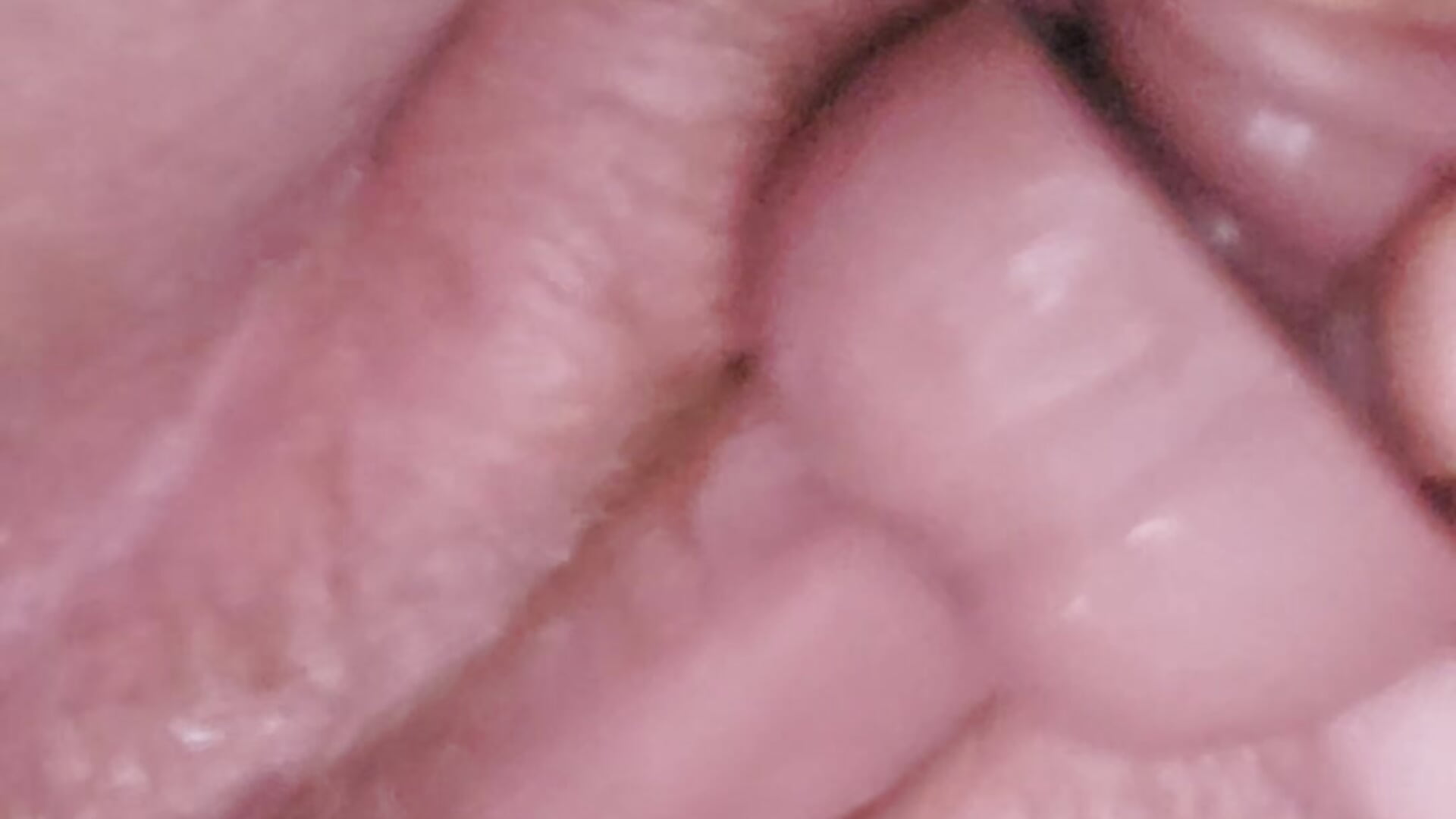 Squirt